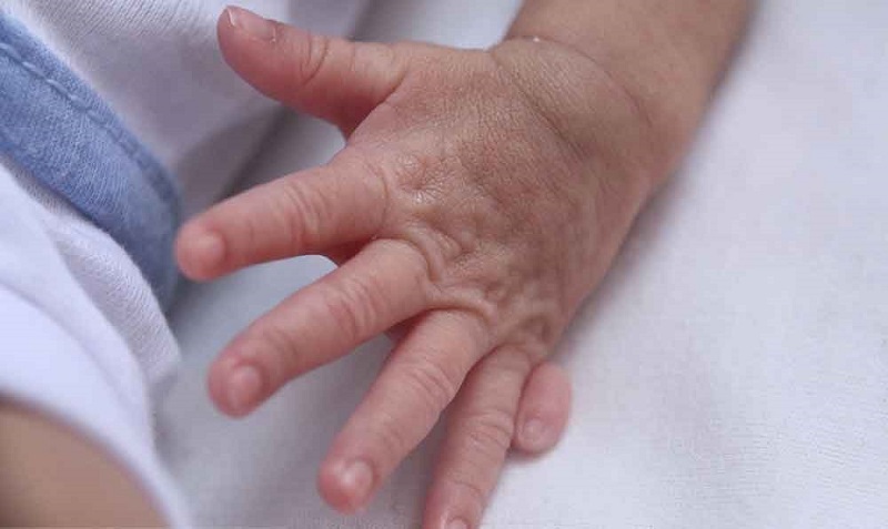  «5 + بى نهایت»؛ وقتی تعداد انگشتان سر به فلک می‌کشد+ تصاویر