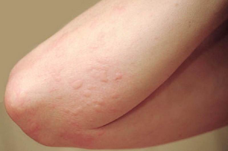 بیماری هایی که ظاهر و باطن شان فرق دارد