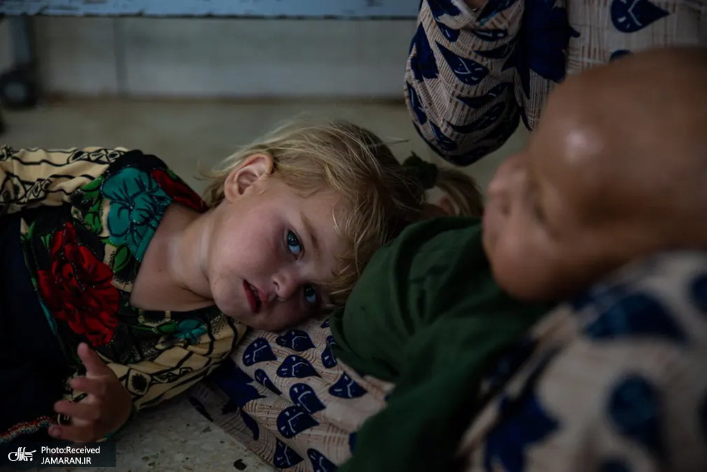 درمان کودکان دارای سوء تغذیه در افغانستان + عکس - تلگرام آپ