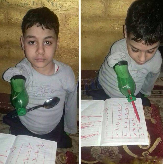 خلاقیت جالب کودکی که مادرزاد دست و پا نداشت! +عکس