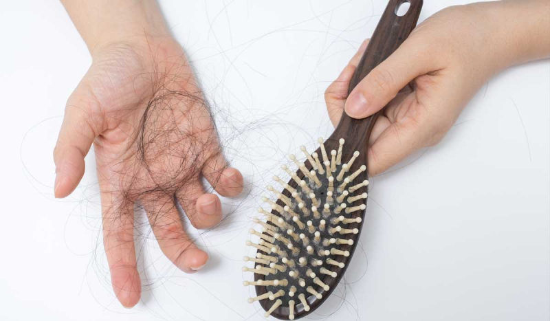 معجزه ای برای ریزش مو