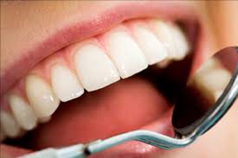  چند روش براي بيمه كردن دندان هاي خود در برابر پوسيدگي