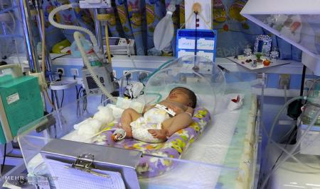 مصرف سیگار یکی از عوامل سقط جنین و مرگ ناگهانی نوزاد