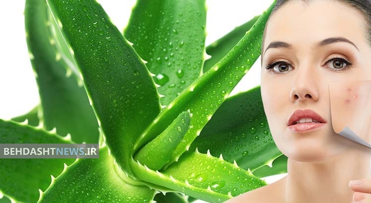  سریع الاثرترین روش‌ها برای از بین بردن جوش های صورت تا  نوروز