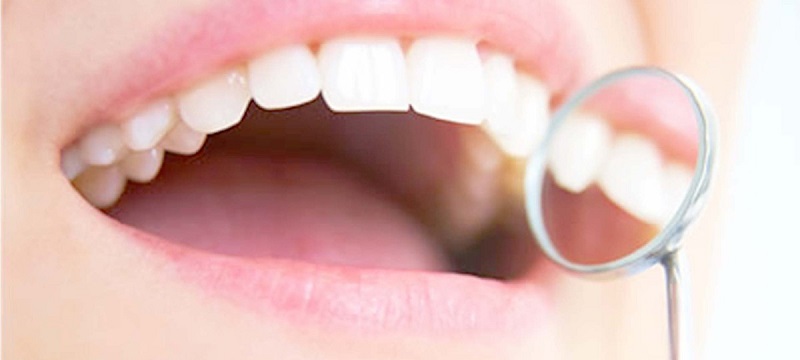 پیش‌بینی اختلالات روانی از روی مینای دندان