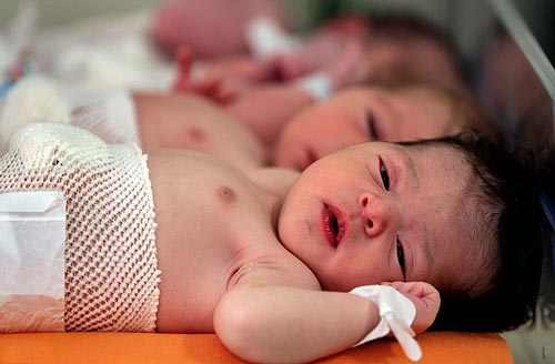 افزایش تعرفه سزارین
