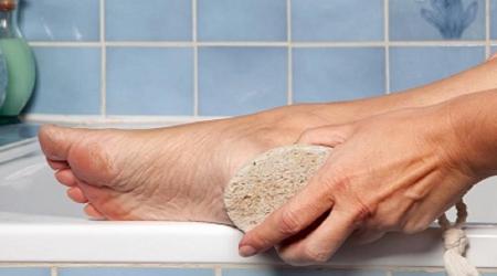 این بیماری را با سنگ پا درمان کنید
