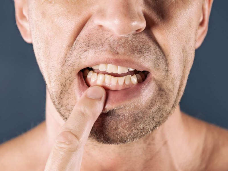 مراقب سلامت لثه هایتان باشید