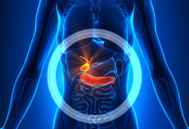  راهکار طب سنتی برای درمان سنگ کیسه صفرا