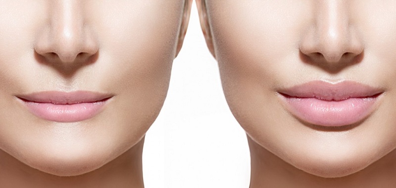 چند روش ساده برای برجسته کردن لب بدون جراحی 
