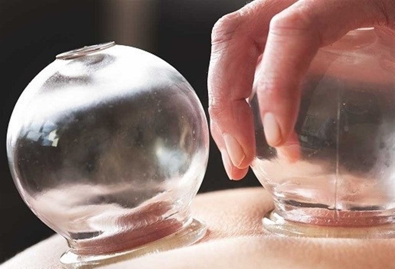تدابیری که اثر حجامت را چند برابر می کند 