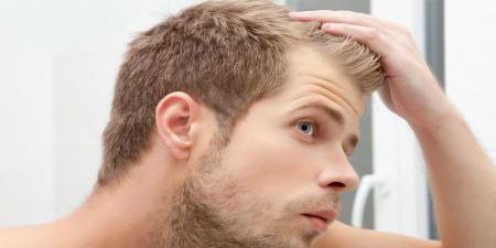 دلایل غیر ارثی ریزش مو