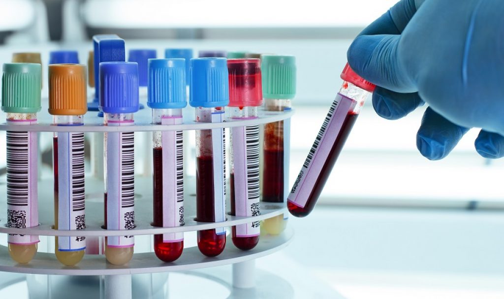  آزمایش خون ساده‌ای که ۸ نوع سرطان شایع رو می‌تواند زودهنگام تشخیص بدهد