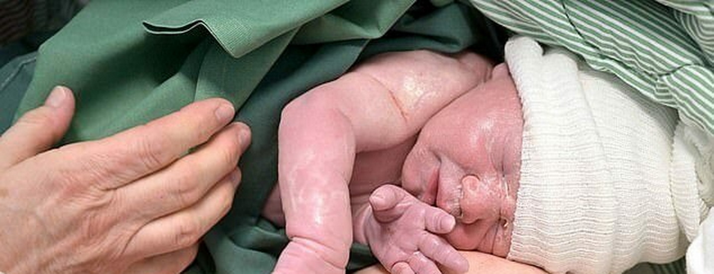  تولد نخستین نوزاد حاصل از پیوند رباتیک رحم