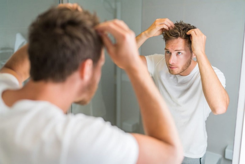 بهترین راه جلوگیری از ریزش مو در آقایان 