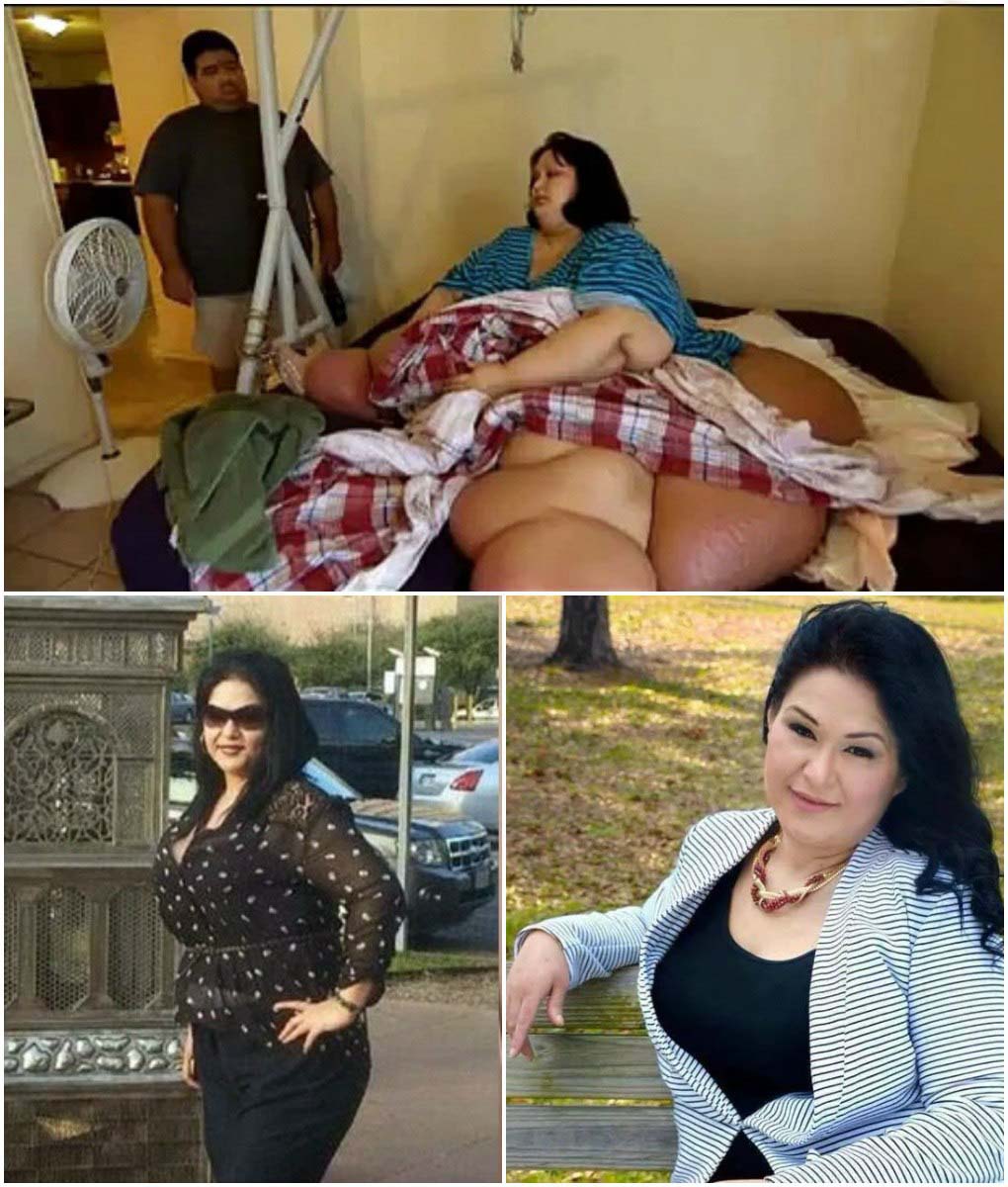چاق ترین زن جهان لاغر شد! +عکس