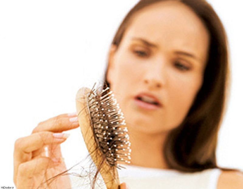 ریزش موی زنانه و نکاتی که درباره آن باید بدانید