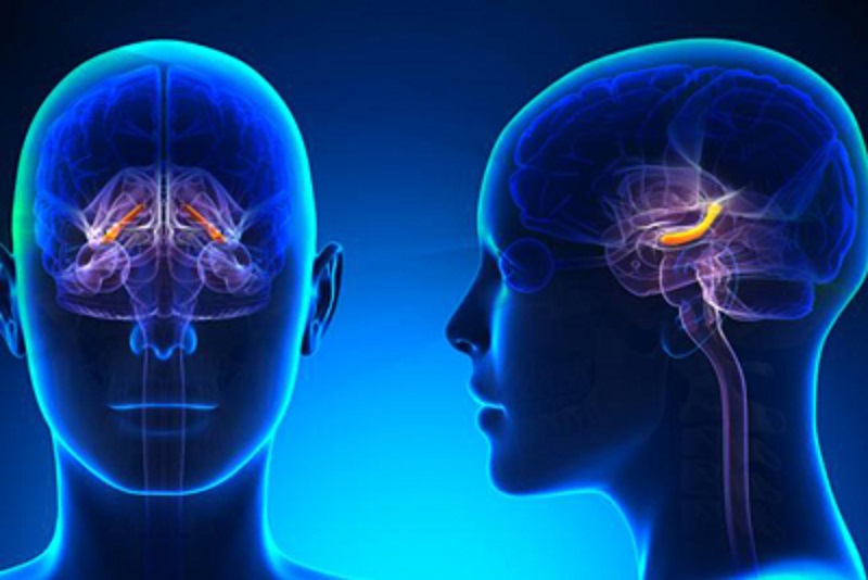  شروع نشانه های بیماری آلزایمر