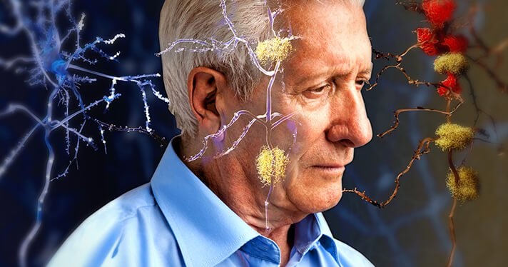 این علائم می گویند مغزتان غیرعادی دارد پیر می شود 