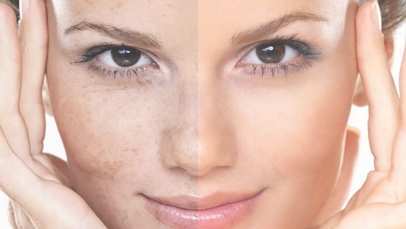 تغییرات رنگ پوست نشانه چیست؟