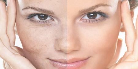 تغییرات رنگ پوست نشانه چیست؟