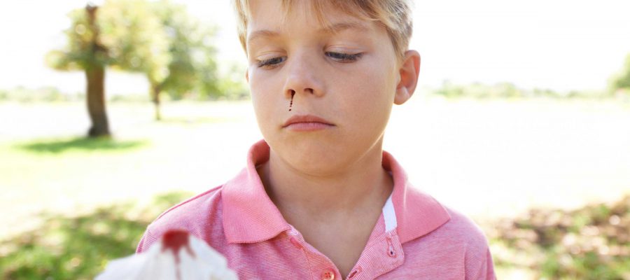 خونریزی بینی نشانه چیست؟