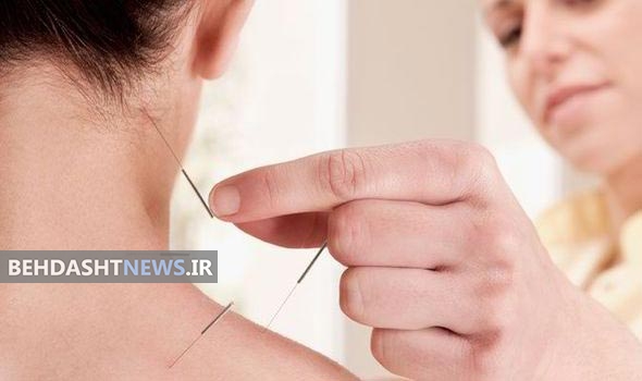  آیا طب سوزنی می‌تواند افسردگی را درمان کند؟ 