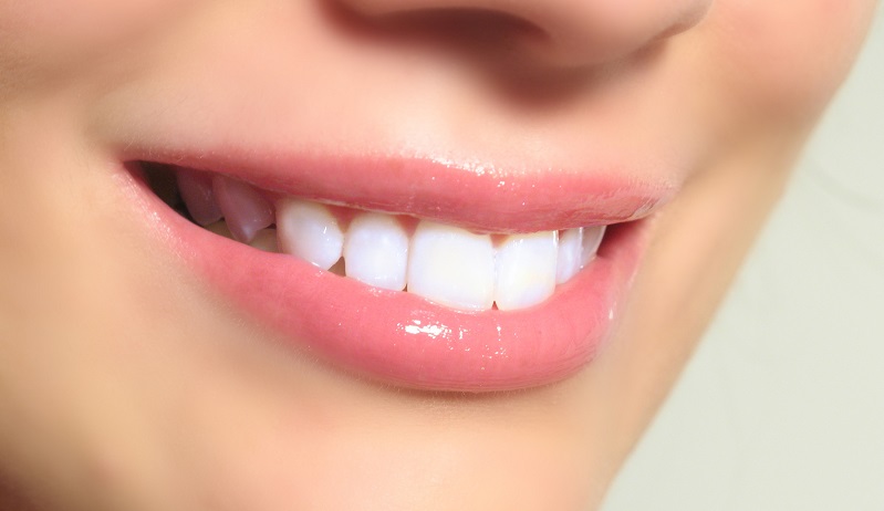 سفید کردن دندان ها در کمتر از سه دقیقه 