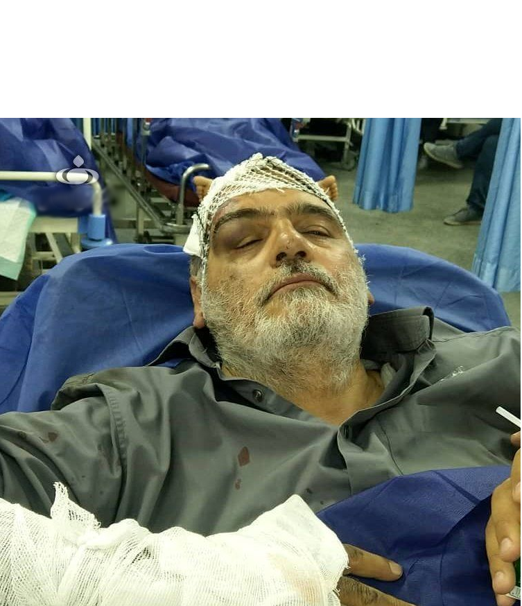 حسین‌ الله کرم دچار سانحه رانندگی شد