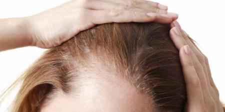 روشهای مقابله با نازکی مو 