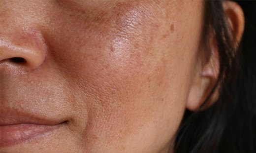 لوازم آرایشی نامرغوب چه بلایی سر پوست تان می آورد؟