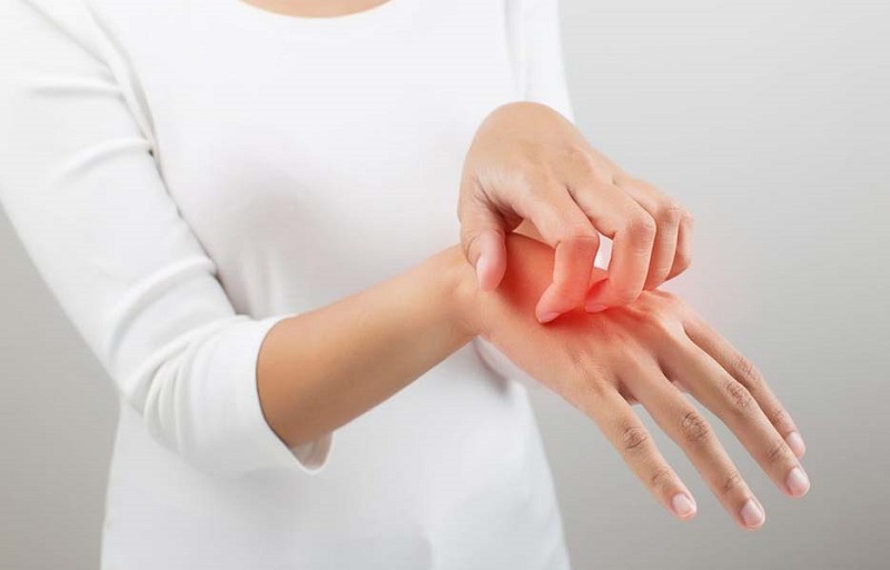 آشنایی با رایج‌ترین عوارض پوستی داروها
