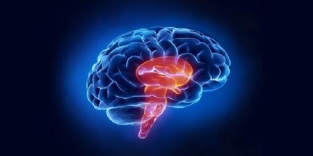 سکته مغزی چقدر به شما نزدیک است؟