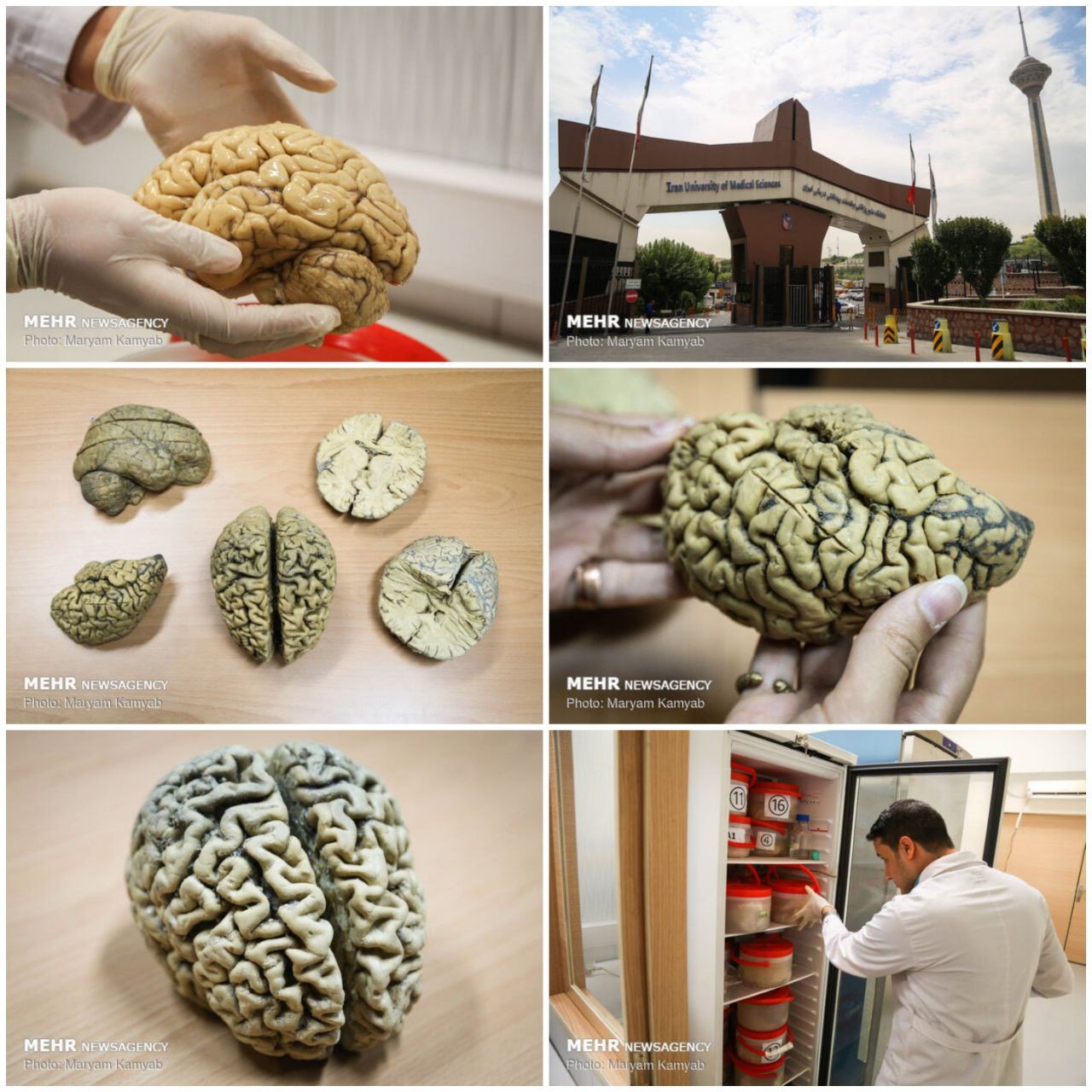 نگهداری از مغز انسان در ایران + عکس