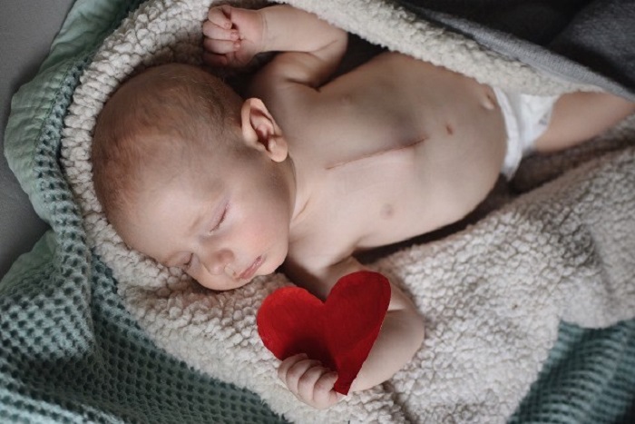 درمان عفونت‌های شدید دریچه قلب نوزادان 