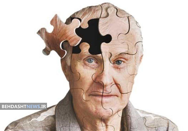 بیماری آلزایمر و درمان ها 