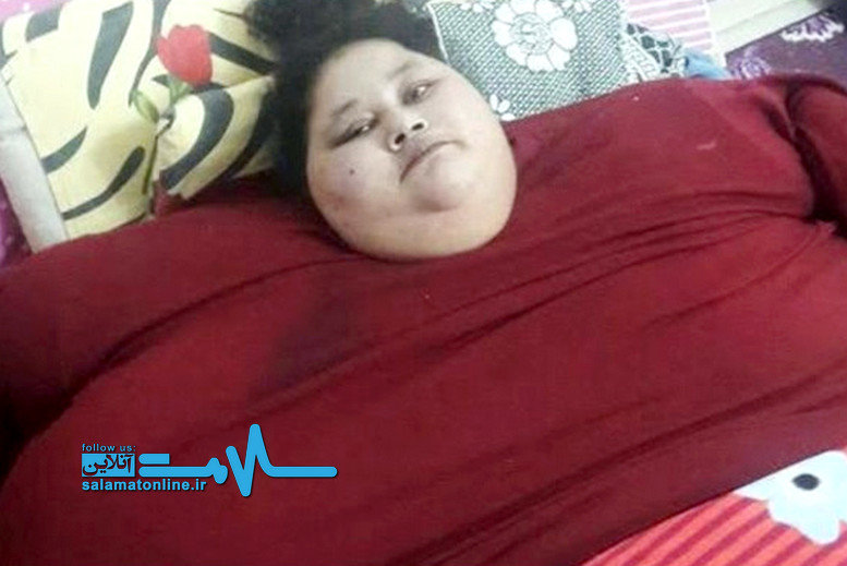  بهت پزشکان از بیماری‌های متعدد «سنگین‌وزن‌ترین زن جهان»