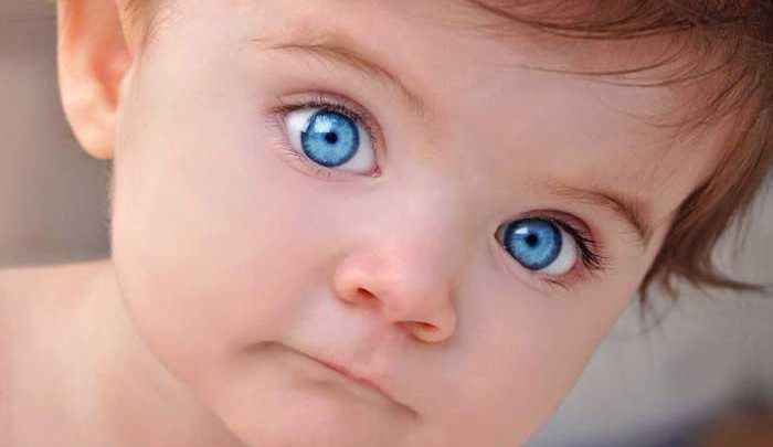 انحراف چشم در کودکان چگونه درمان می‌ شود؟