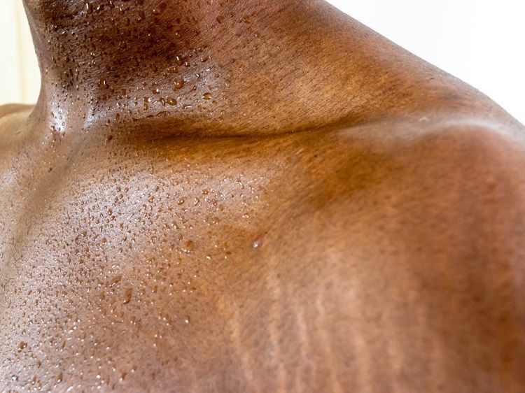 ترك هاي پوستي درمان دارد؟