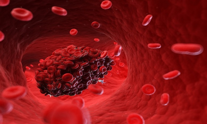  15 نشانه ترسناک وجود ه خون در بدن