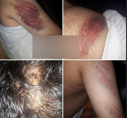 حمله خانواده دانش آموز شلاق خورده به معلم + تصاویر