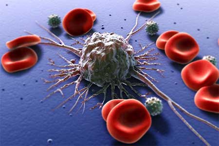  سلول های سرطانی چگونه ریشه می کنند؟ 