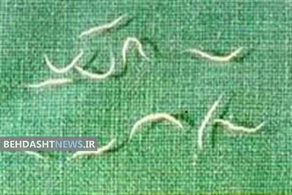 روش های درمانی موثر برای کرمک در کودکان