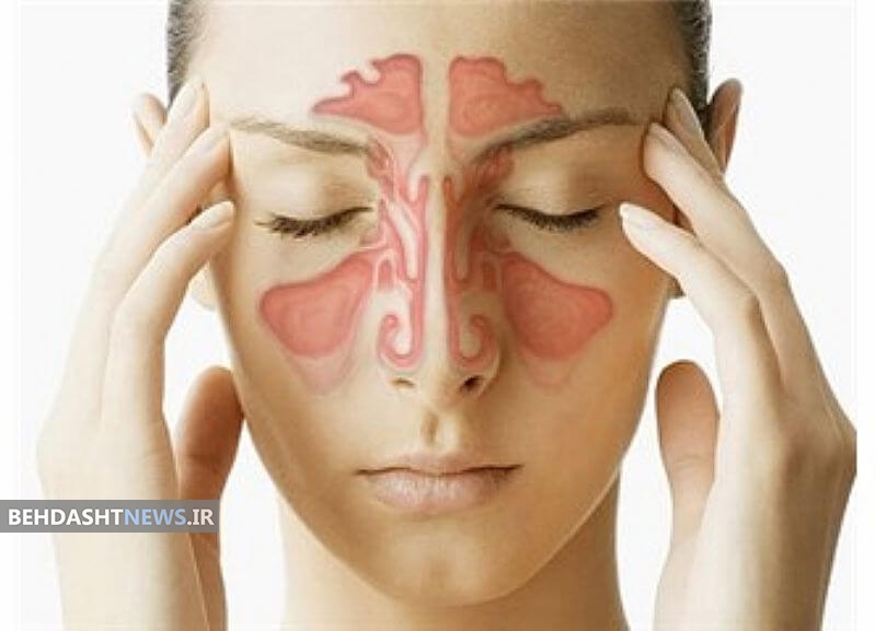 بایدها و نبایدها برای کسانی که سینوزیت دارند 