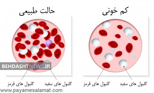 نسخه هایی برای درمان کم خونی
