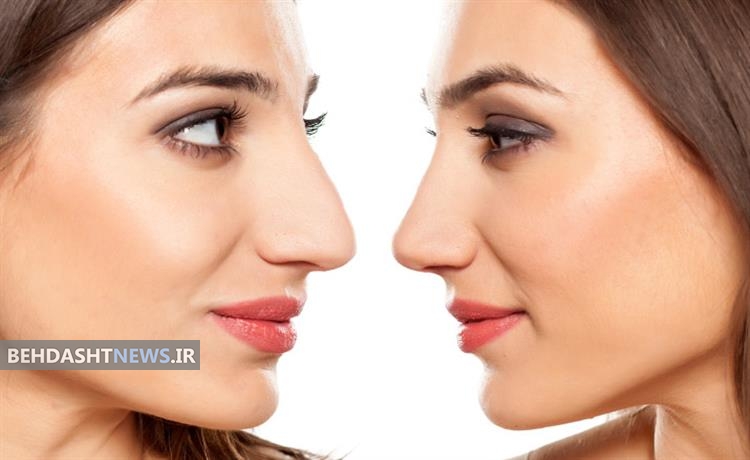 جراحی زیبایی بینی: آیا ارزشش را دارد؟