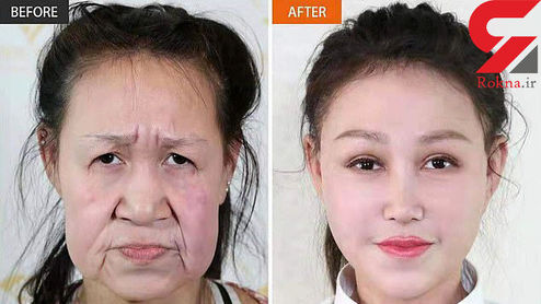 جراحی زیبایی یک پیرز‌ن را به د‌ختری ۱۵ ساله تبدیل کرد! + عکس