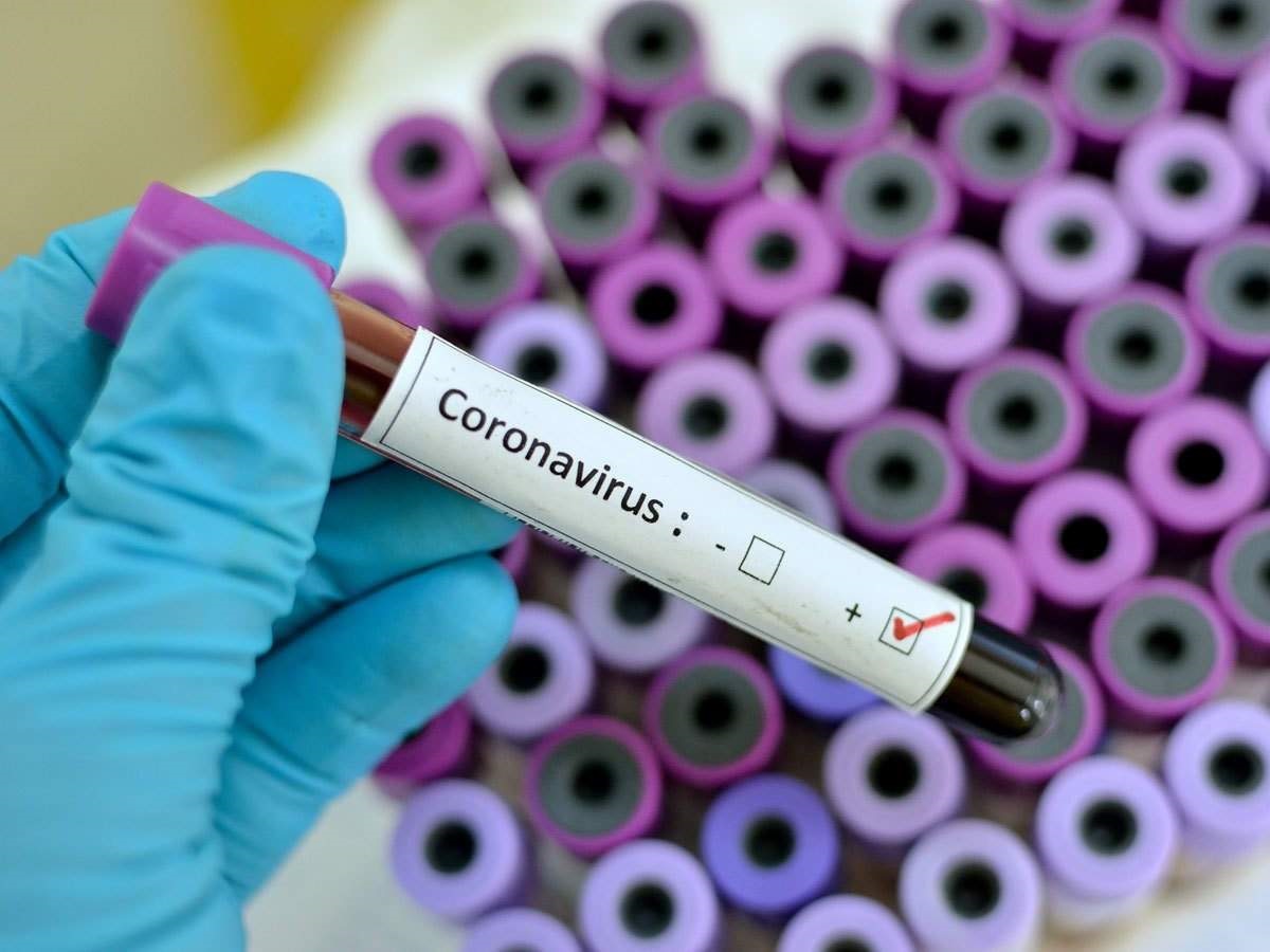 تشخیص ویروس کرونا در 15 دقیقه