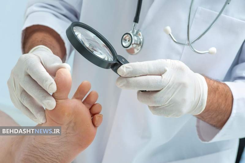 مراقبت از پا در مریض هاى دیابتى