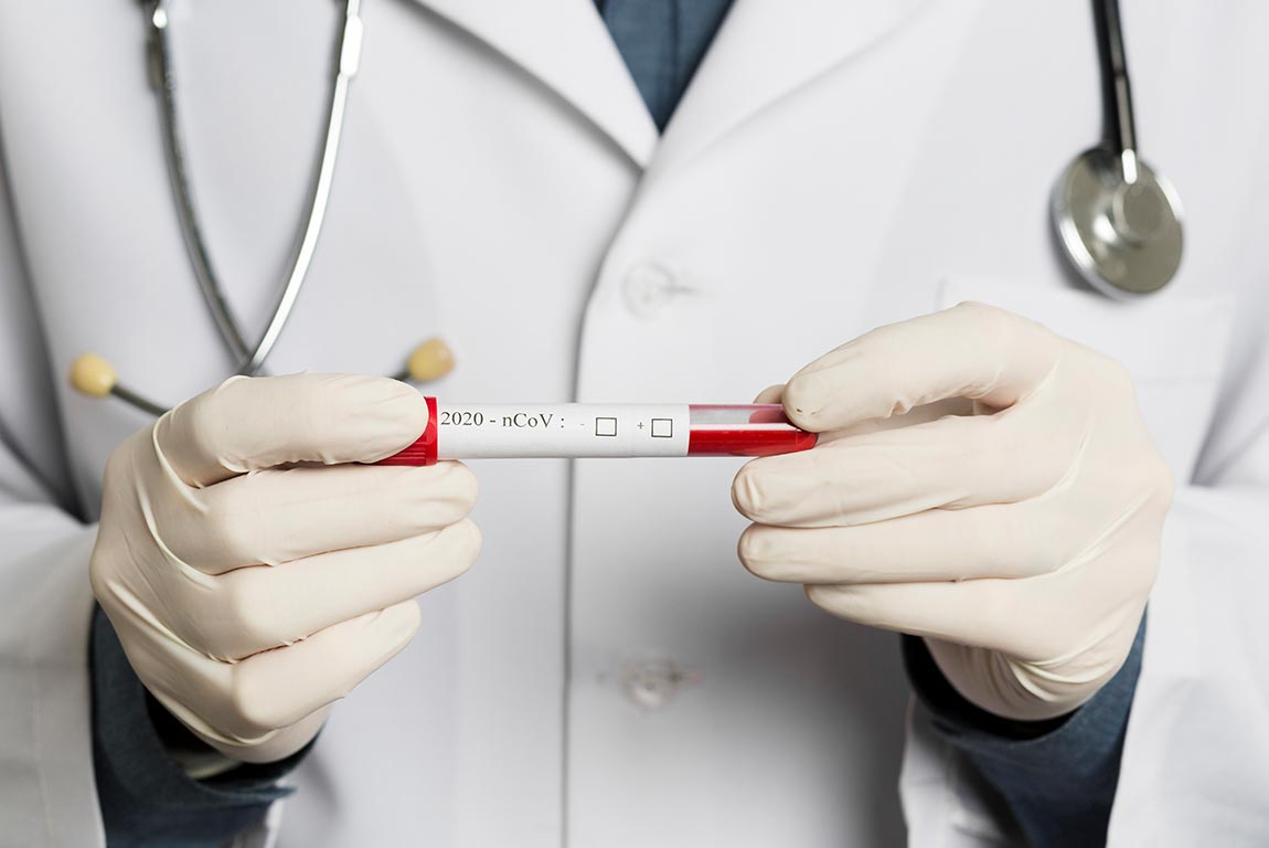 وضعیت «نمودار» کرونا در ایران/ سه ماه حیاتی برای عبور از بحران